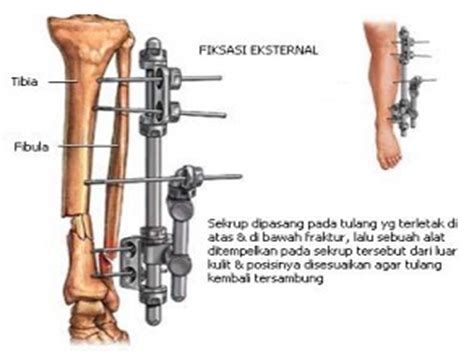 Yuan S Nk Fractures And Dislocations