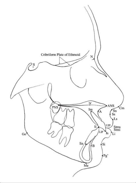 Cephalometric Landmarks Download Scientific Diagram