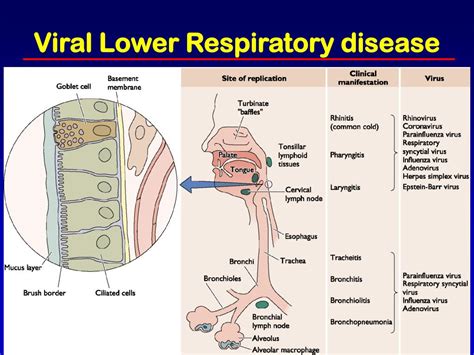 Ppt Lower Respiratory Tract Viral Infections`` Powerpoint Presentation Id 2046152