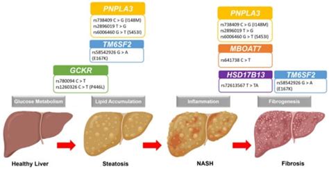 Biomedicines Free Full Text Genetic Polymorphisms And Diversity In Nonalcoholic Fatty Liver