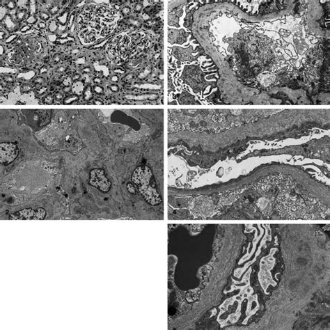 Higher Magnification Electron Micrograph Showing Parts Of Two