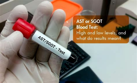 Ast Or Sgot Blood Test High And Low Levels And What Do Results Mean