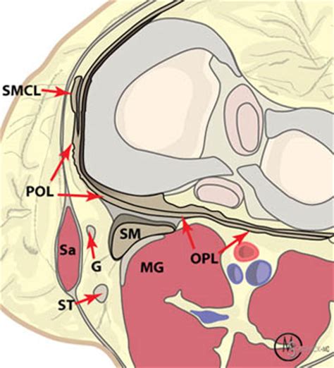 Oblique Popliteal Ligament Mri