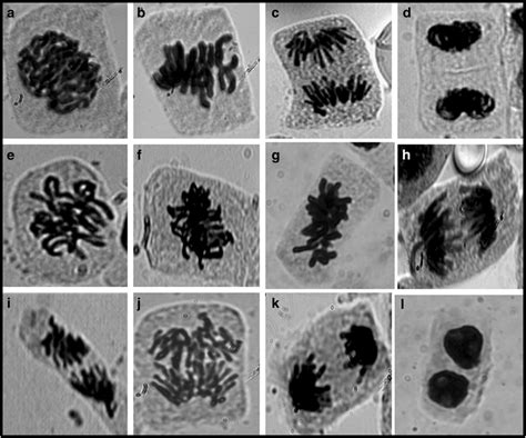 Normal Stages Of Mitosis A Prophase B Metaphase C Anaphase D