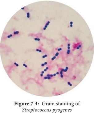 Streptococcus Pyogenes Flesh Eating Bacteria Morphology Cultural