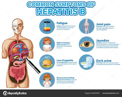 Informative Poster Common Symptoms Hepatitis Illustration Stock Vector by ©interactimages 645747932