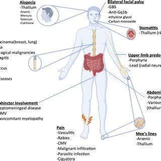 Clinical algorithm for approaching cases of suspected GBS + CNS. ADEM ...