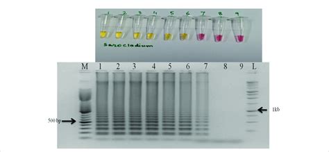 Sensitivity Of The Lamp Assay When Performed With 10 Fold Serial Download Scientific Diagram