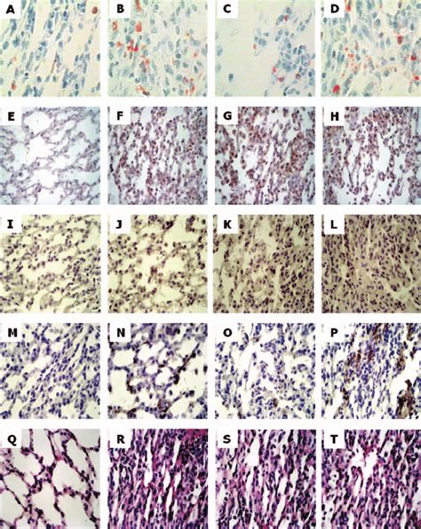 Photomicrographs Of Lung Tissue Stained For Eosinophils A B C And