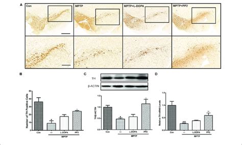 Src Inhibition Enhanced The Survival Of Dopaminergic Neurons Of The