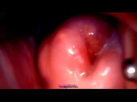 AdalynnX Mirar En La Vista De Mi Endoscopio Cervical XVIDEOS