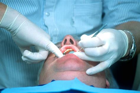 European Ban On Silver Fillings Could Be Straw That Breaks NHS