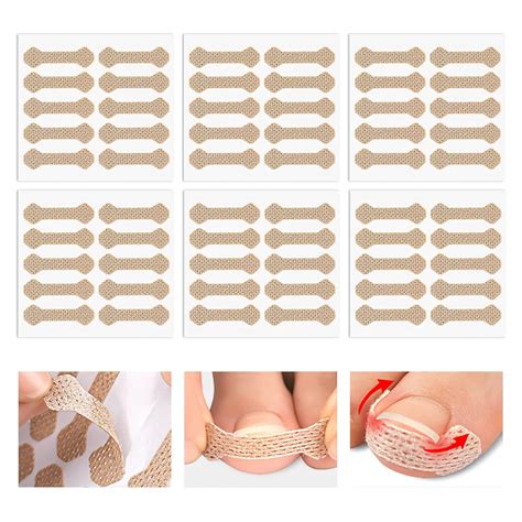 Ingrown Toenail Quick Fix at Brooke Bermingham blog