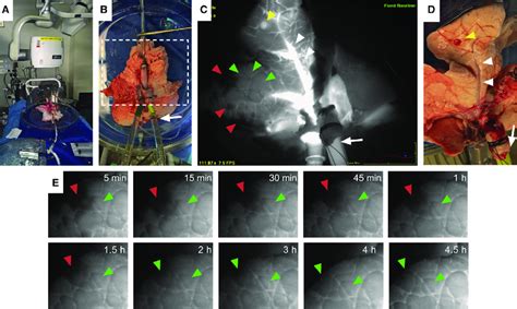 Figure E Developing Near Infrared Fluorescence Nirf Imaging