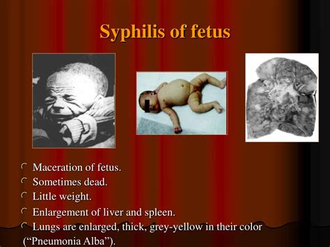 Ppt Tertiary And Congenital Syphilis Principles Of Therapy And