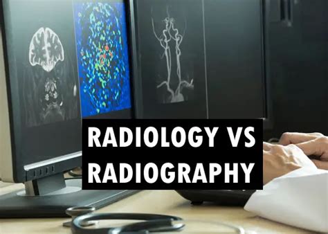 Radiology Vs Radiography Exploring Differences And Careers