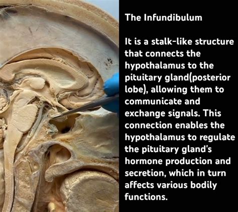 Infundibulum Function Mbbs Anatomy Mbbs Youtube