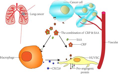 Frontiers Combination Of Serum Amyloid A And C Reactive Protein