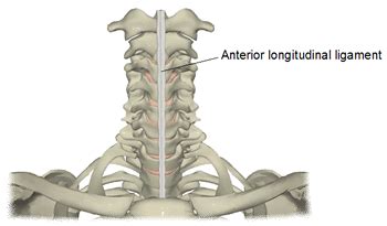 Anterior Longitudinal Ligament Injury