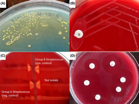 Bacitracin Test