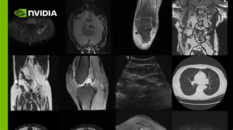 Create Infinite Medical Imaging Data With Generative AI GTC Digital