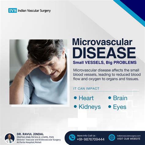 Dr. Ravul Jindal (Vascular & Endovascular Surgeon) | Microvascular