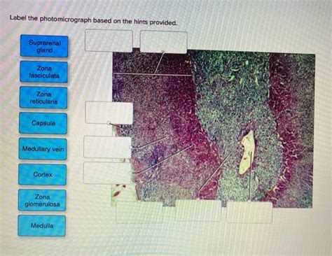 Solved Label The Photomicrograph Based On The Hints Chegg