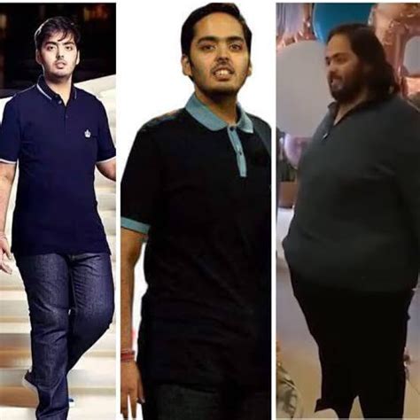 Understanding Anant Ambani S Health Challenges A Deep Dive