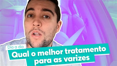 Qual O Melhor Tratamento Para Varizes YouTube