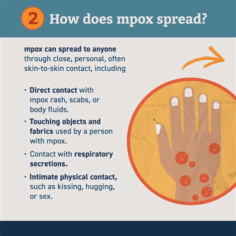 Social Media Toolkit Mpox Poxvirus Cdc