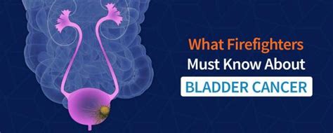 What Firefighters Must Know About Bladder Cancer Cxbladder