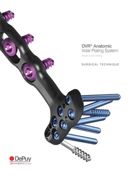 Pdf Dvr Anatomic Volar Plating System Norskmetodebok Ortopedi