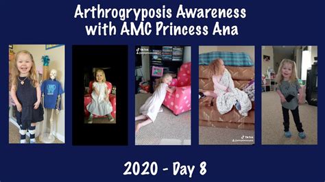 2020 Arthrogryposis Awareness With Amc Princess Ana Day 8 Youtube