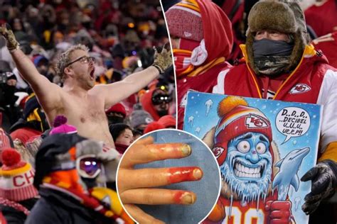 Kansas City Chiefs fans suffering frostbite, need amputations after ...