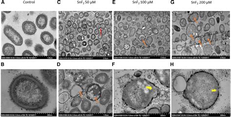 Frontiers Stannous Fluoride Forms Aggregates Between Outer And Inner