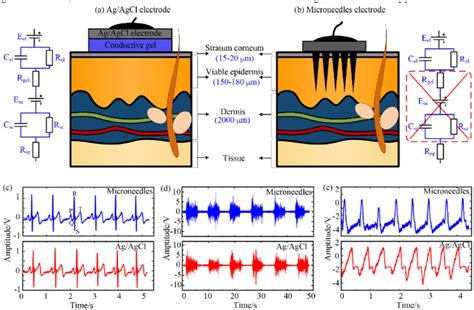 Typical Bio Signals Measured By Ag AgCl Electrode And Microneedles