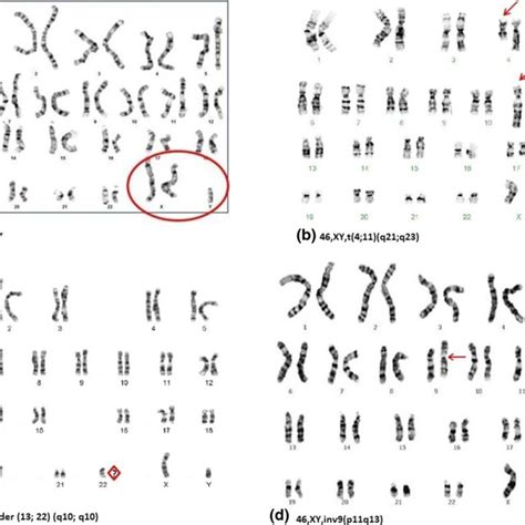 Y Chromosome Microdeletion Testing A Schematic Diagram Of Human Y Download Scientific Diagram