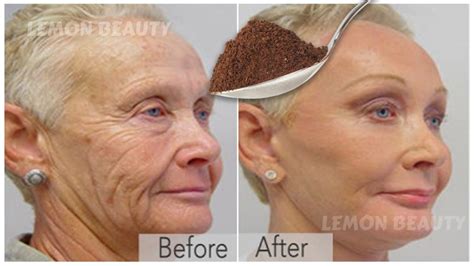 Anti Aging Mask In 3 Days Tightens The Skin And Fills In Wrinkles And