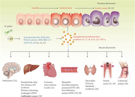 Figure From The Role Of H Pylori Caga In Regulating Hormones Of