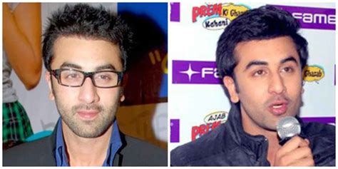 Ranbir Kapoor Hair Transplant | Longevita