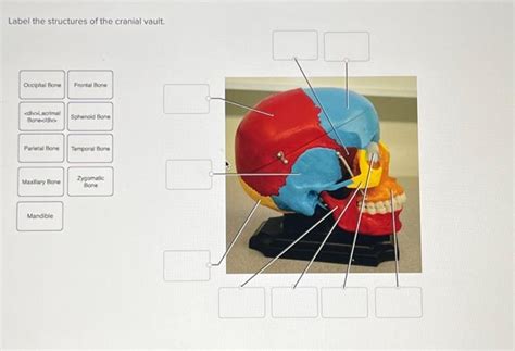 Solved Label The Structures Of The Cranial Vault Occipital Chegg