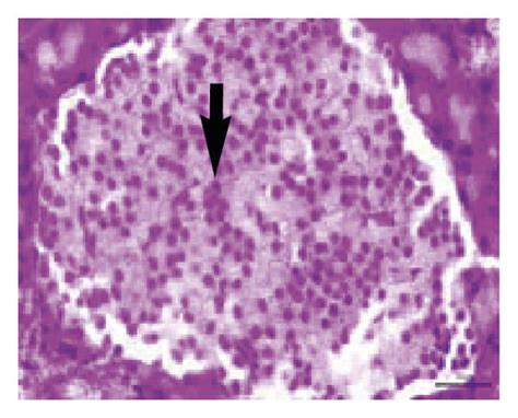 The Pancreatic Histology Of Rat At The Blank Control And Various Download Scientific Diagram