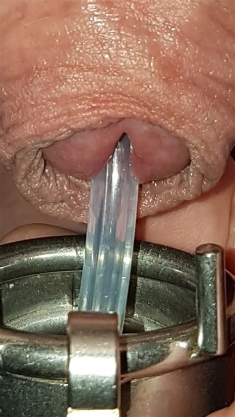 Urethral Insertion 80 Nude Pics XHamster