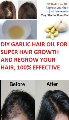 Garlic Benefits For Hair Growth