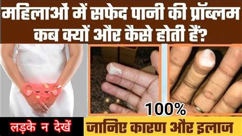 सफेद पानी का 101 सफल ईलाज Dawai Doctor Healthcaretips Treatment