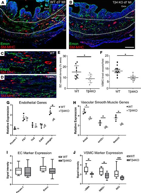 Neovascularization Is Diminished In The Infarct Border Zone Of Thymosin