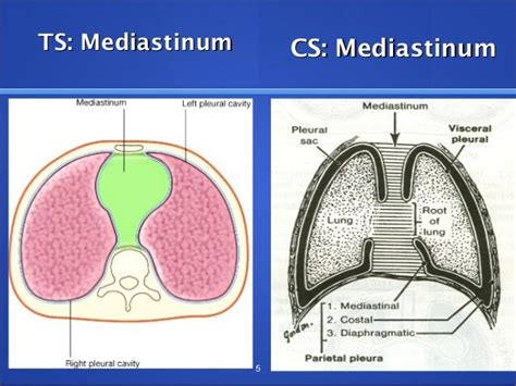 Mediastinal tumors