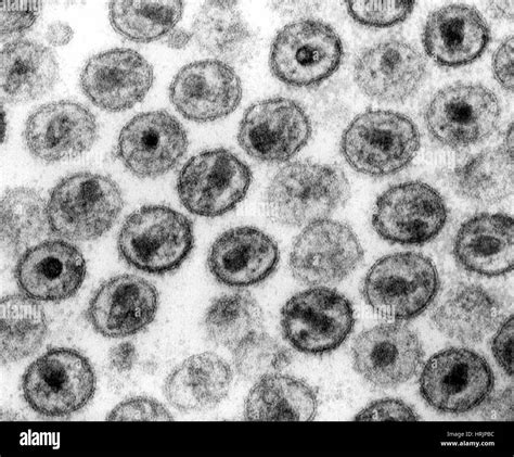 Hiv Virus Under Electron Microscope