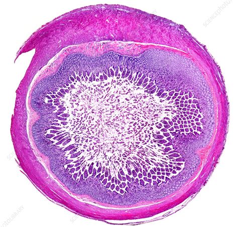 Human Jejunum Light Micrograph Stock Image C048 8548 Science