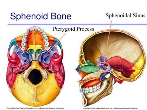 Ppt Exercise 7 Powerpoint Presentation Id 1786520